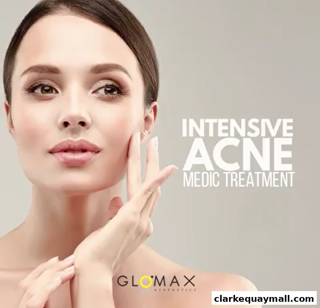 A woman's face with text promoting intensive acne medic treatment from Glomax Aesthetics.