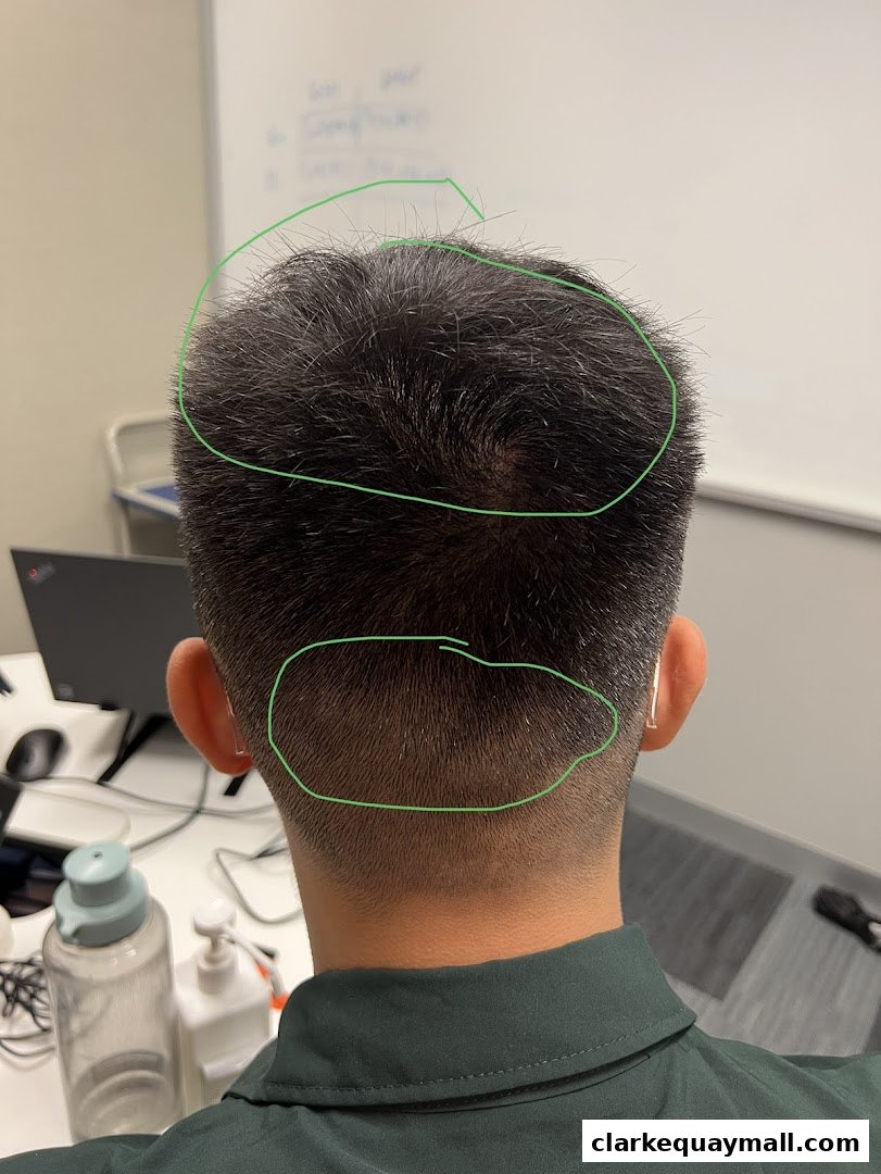 Back view of a person's head with green circles highlighting hair areas.