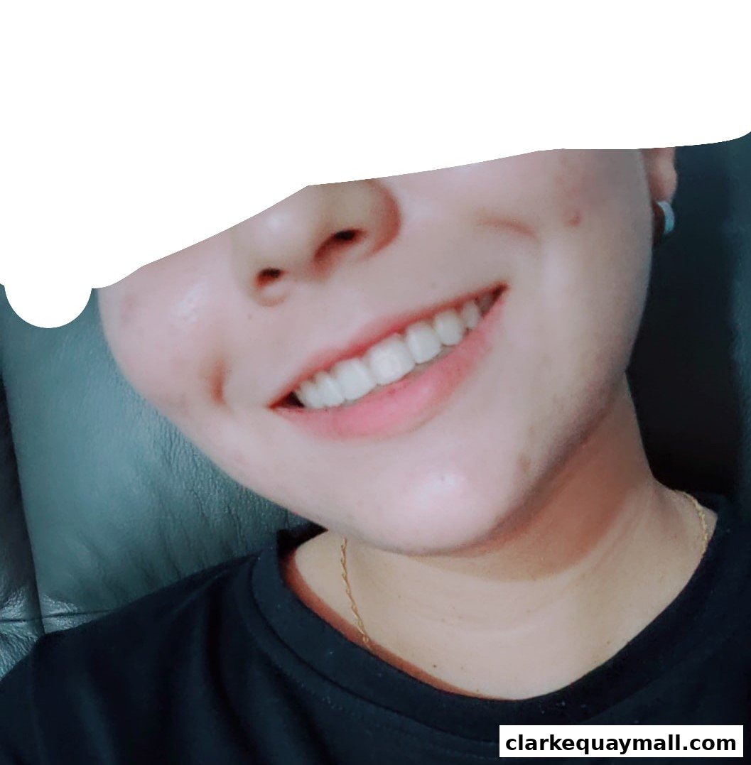 Close-up of a person's smiling mouth and nose, with a white overlay obscuring part of the face.